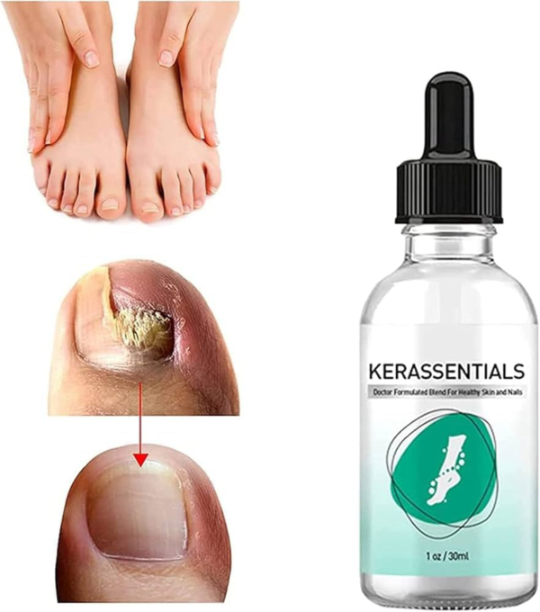 Kerassentials™ Official Website – Nail Care & Skin Support