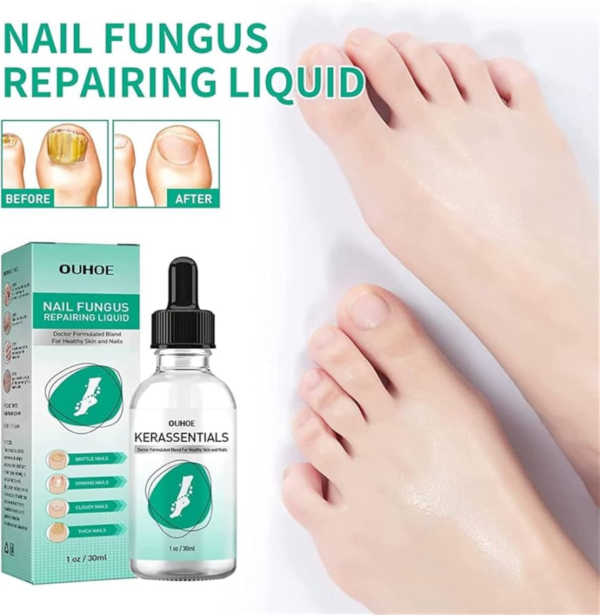 Kerassentials™ Official Website – Nail Care & Skin Support